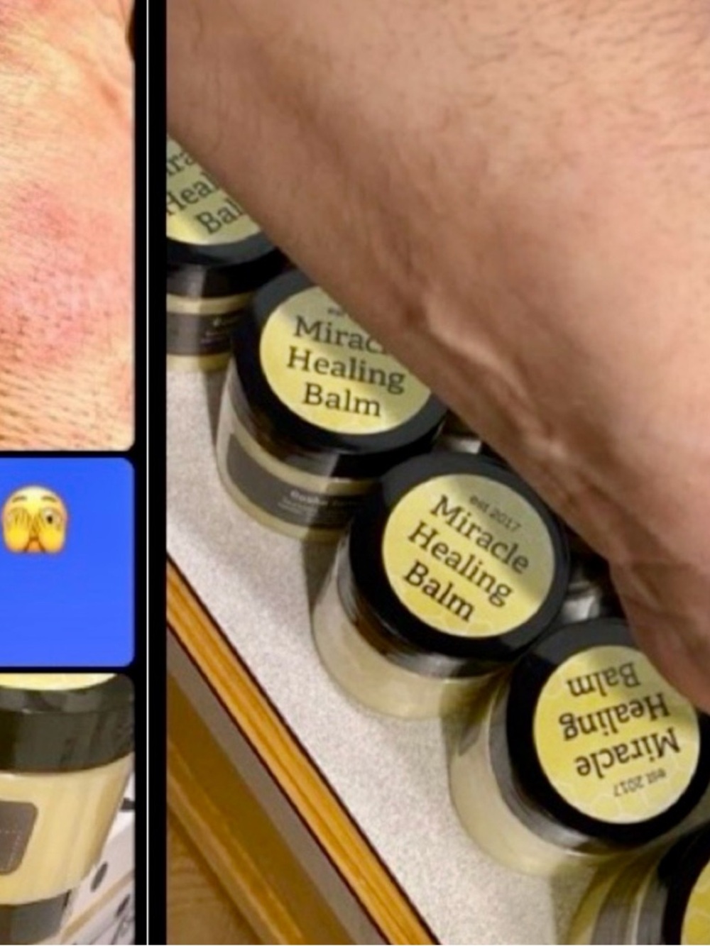 MIRACLE 👑 HEALING ❤️‍🩹 BALM - 5 ⭐️ #beard #burns #razorburn #cuts #razorburn